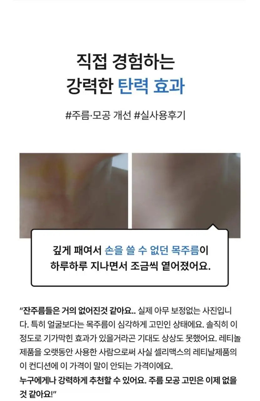 [단독기획/모공탄력] 셀리맥스 더 비타 A 레티날 샷 타이트닝 부스터 15ml 기획(+3ml) 상세페이지 4